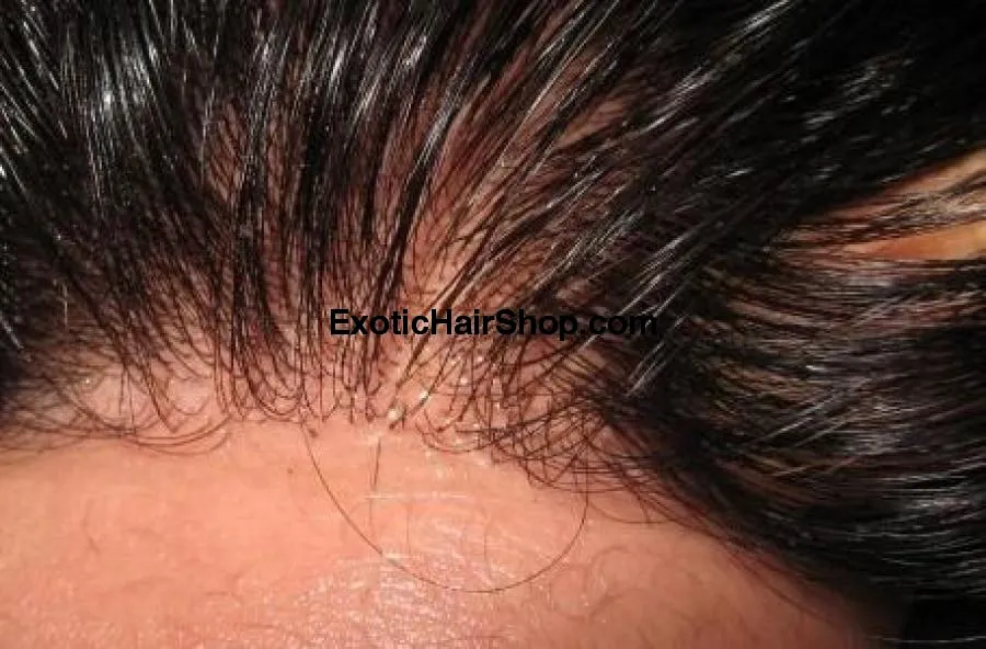HD Thin Lace Frontal - 13x6